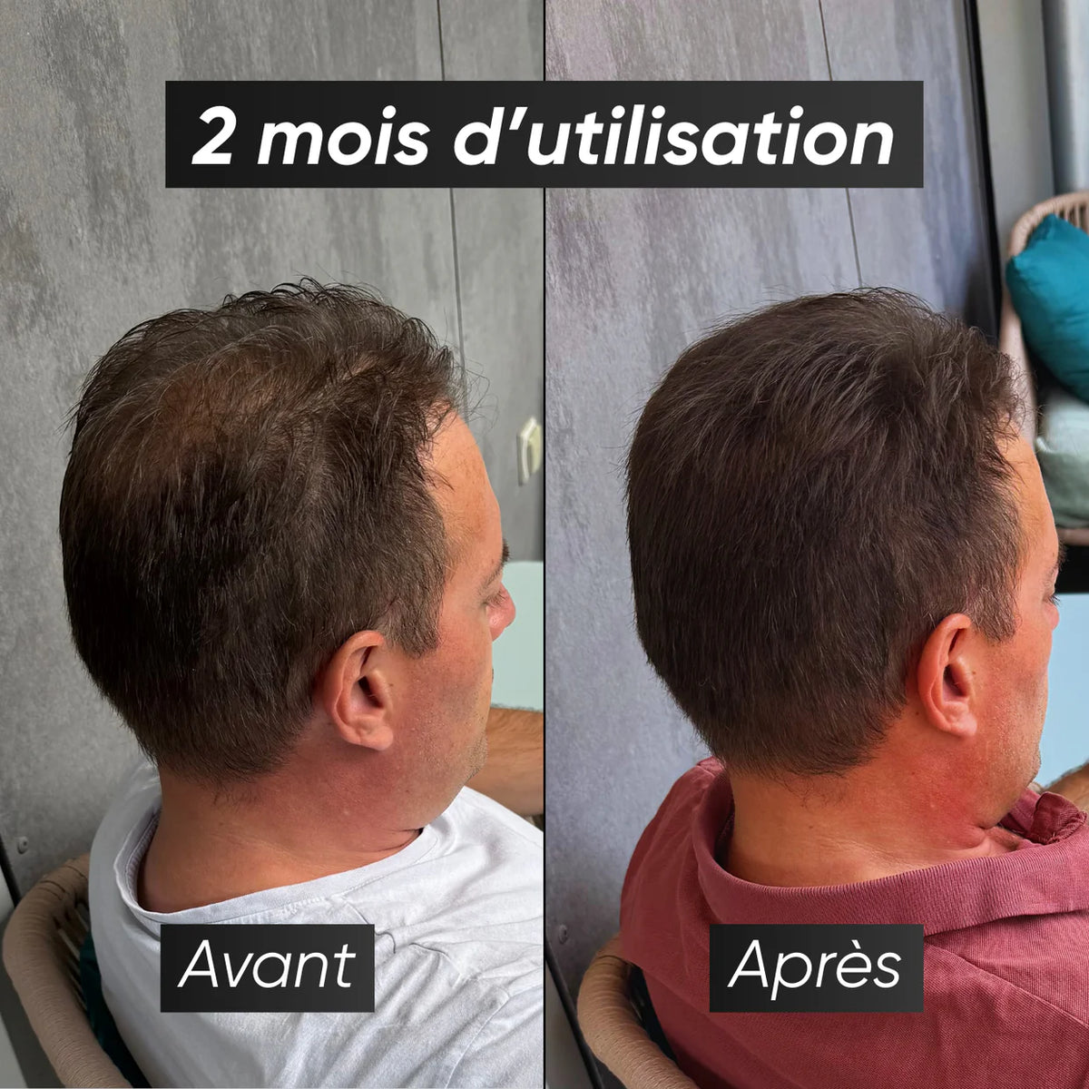 Nuvora - Sérum anti-chute & repousse de cheveux